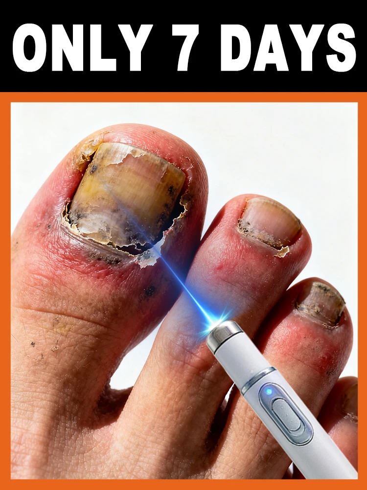 

Protect the healthy environment of the ᶠᵉᵉᵗ ᵃⁿᵈ ᵃᵛᵒⁱᵈ ᵇᵃᶜᵗᵉʳⁱᵃˡ ⁱⁿᶠᵉᶜᵗⁱᵒⁿ ᵃⁿᵈ ᵒᵈᵒʳ