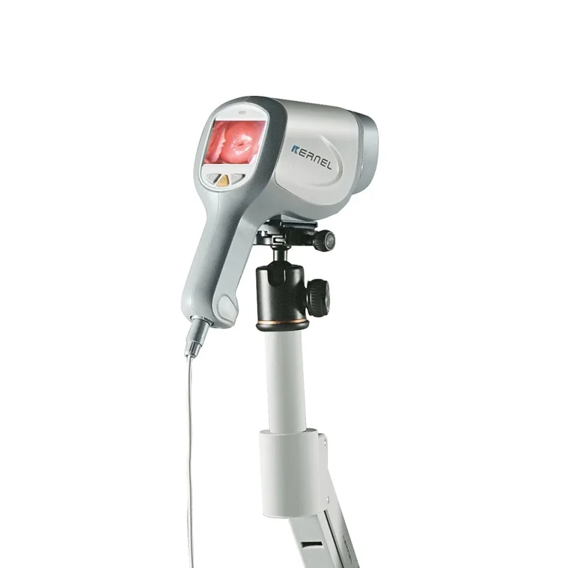 KN-2200A gynecological SONY color digital camera CCD Trolley video colposcope for vagina examination