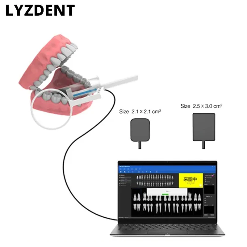 Dental Suplies Dentistry Camera Sensor X-Ray High-Frequency Rx Digital Intraoral Digital System H D Image Radiovisografo Tools