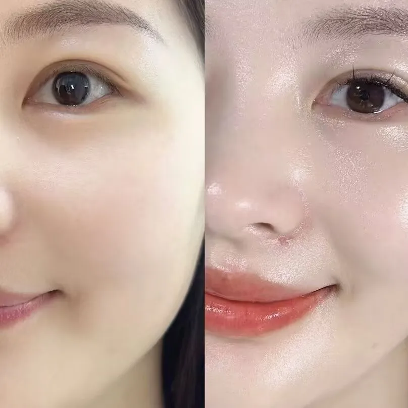 SKIT Huangqi Cream Hidratante, hidratante, reafirmante, líneas de luz, crema facial a base de hierbas, crema antiarrugas