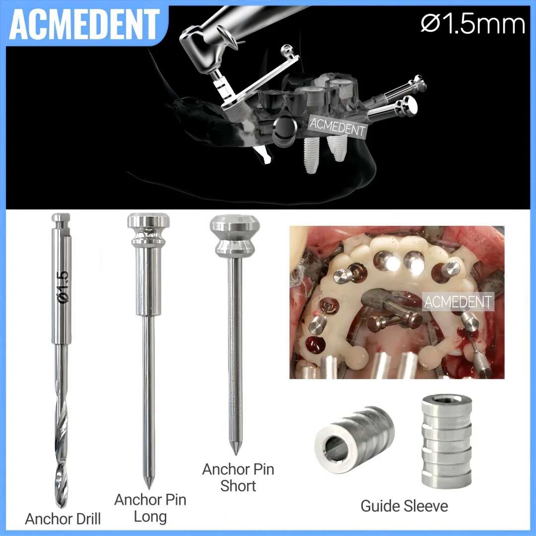 

∅1.5 Dental Guided Twist Anchor Drill Anchor Pin S&L Universal Guide Sleeve Position Locator Tool For Fix Implant Guide Plate