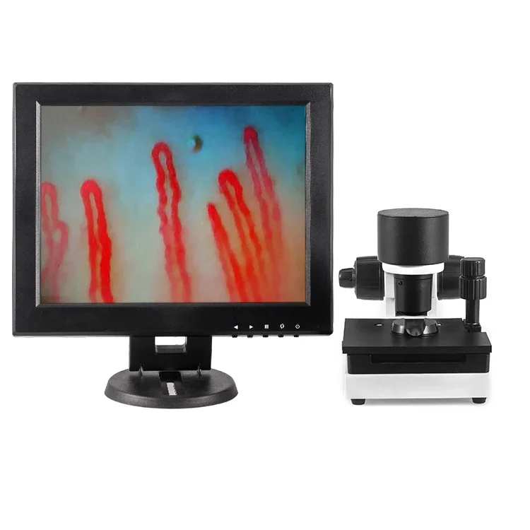 Large LCD screen 12 inches capillary microcirculation microscope nailfold detector blood health scanner