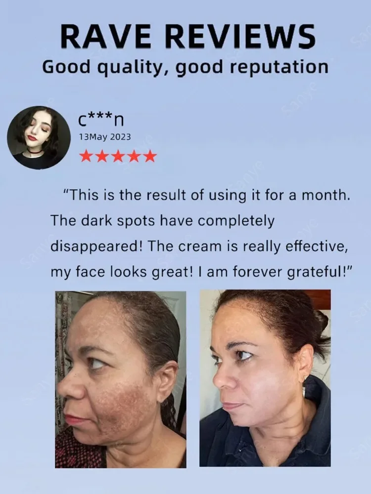 Face Dark Spots Remover for Women Remove Melasma Freckles Cream Removal Melanin Whitening Cream Fade Spots Skin Brightening Care