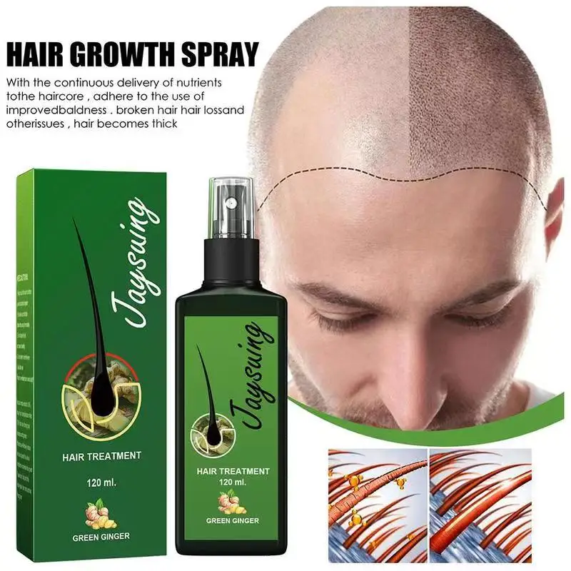 

Fast Ginger Hair Growth Spray Roots Grow Anti Hair Loss Serum Liquid Scalp Damaged Treatment Repair Care Products Beauty Health