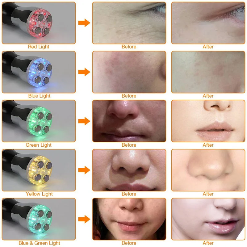 フェイスマッサージローラー LED ライトフォトンフェイシャルメソセラピーエレクトロポレーションフェイスリフトローラー美容機肌引き締め