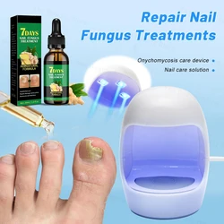 Toenail Nail Fungus Treatment Repair Fingernail Device Toenail Treatment for Foot Nail Fungus Essential Oil Onychomycosis Care