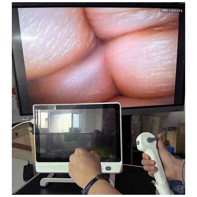 SY-P029-3 High Quality Single-use Ureteroscope Semirigid Video Flexivel