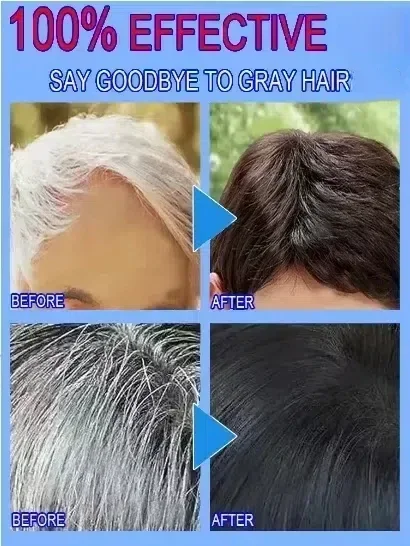 Black Hair Regeneration Tonic, Turning Grey into Black Is No Longer a Dream