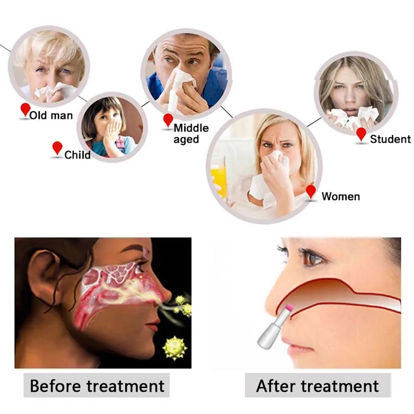 Rhinitis Laser Therapy Device Nose Care Device Proxy Therapy Machine Nose Rhinitis Sinusitis Cure Hay Fever Laser Dropshipping