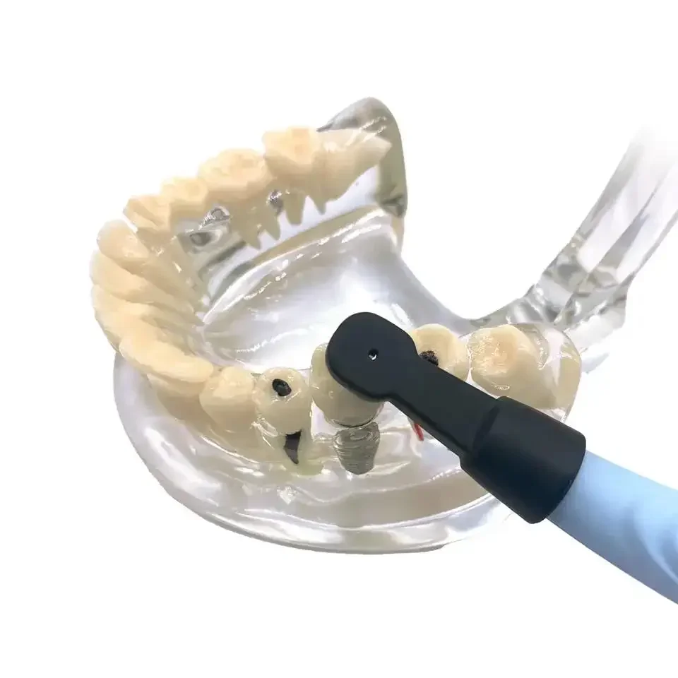 

Locating Screw Precisely Easyinsmile Treatment Detector Rotating 270