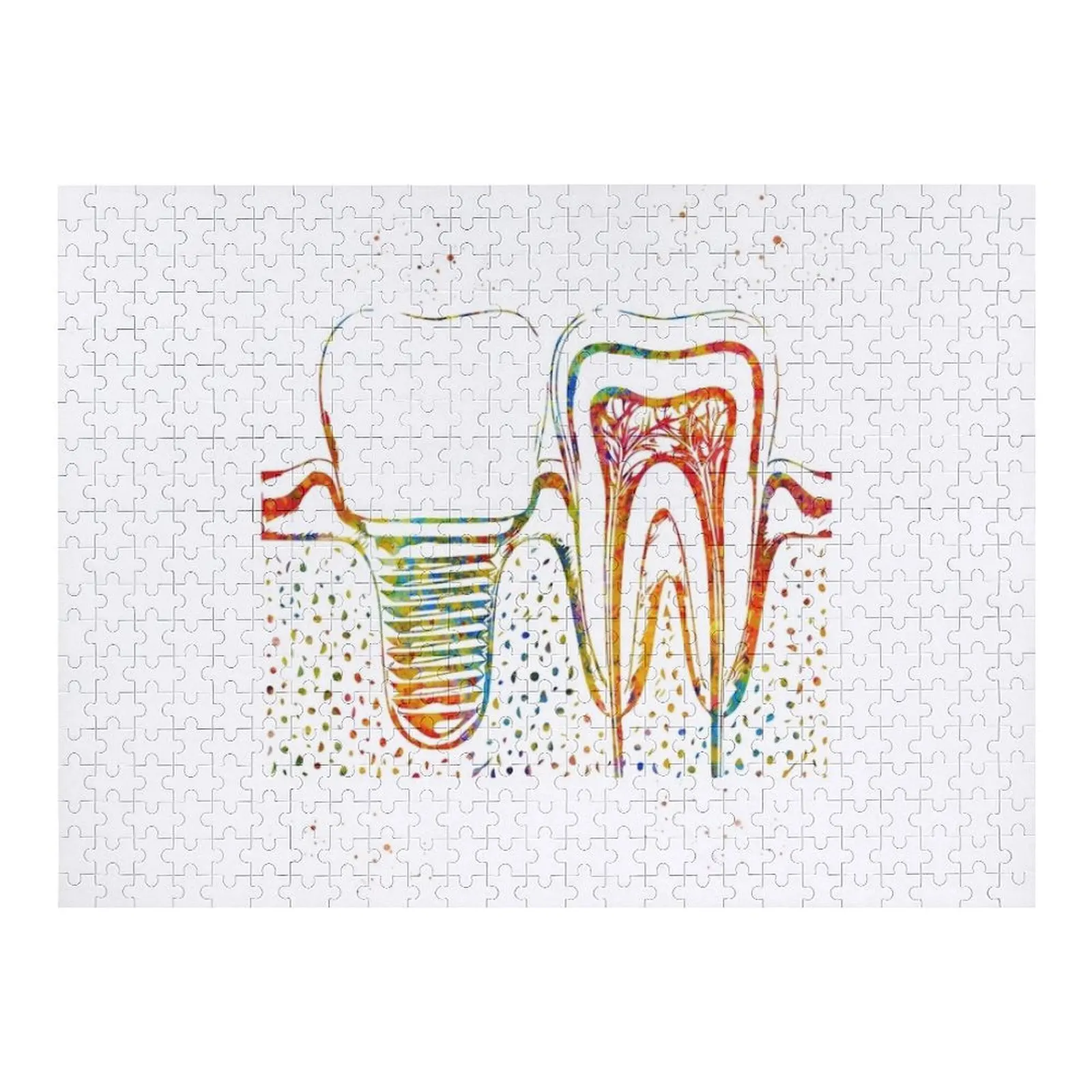 

Human teeth and dental implant Jigsaw Puzzle Baby Toy Wood Adults Photo Personalized Gifts Puzzle