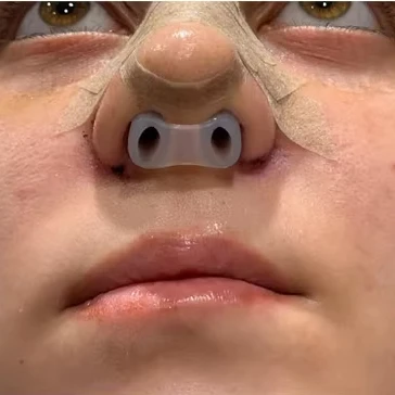 

Medical Grade Silicone Nasal