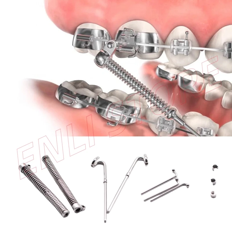 1 Set Dental Orthodontic Class II Corrector Fatigue Resistant Device Push Rod 22/25/29/32/35/38mm Forsus