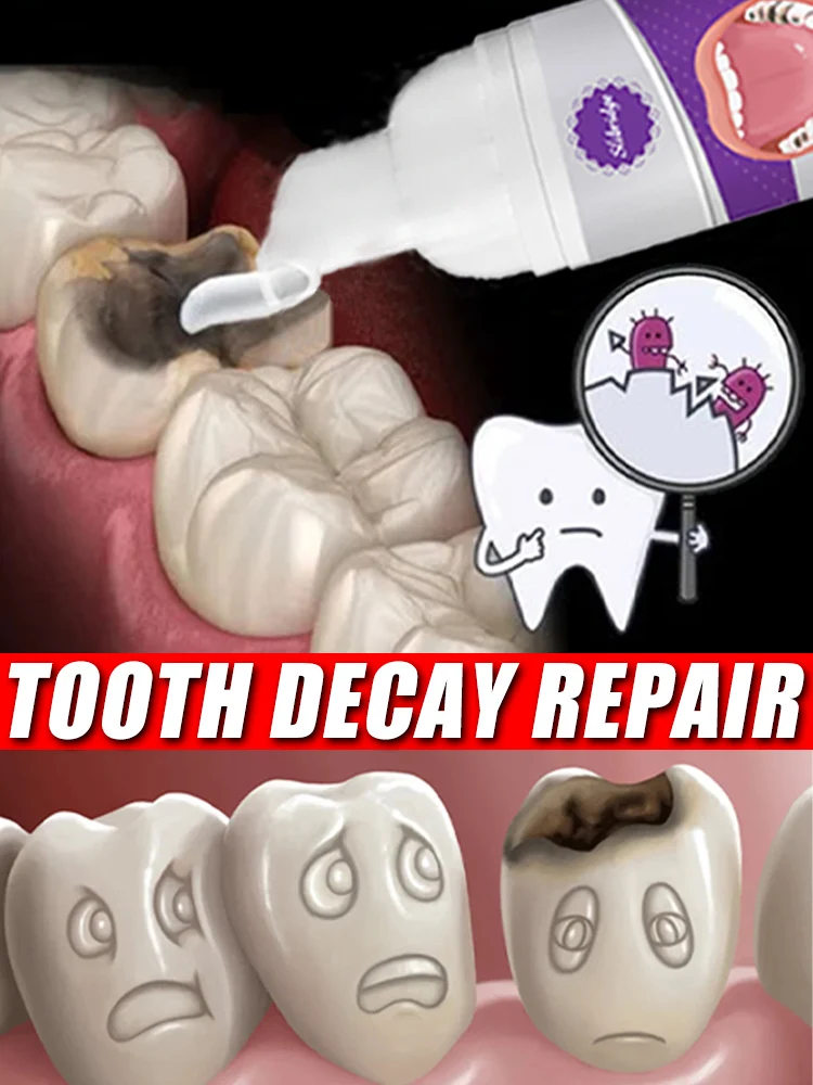 Tooth decay Repair Repairing Cavities Anti Protecting Caries