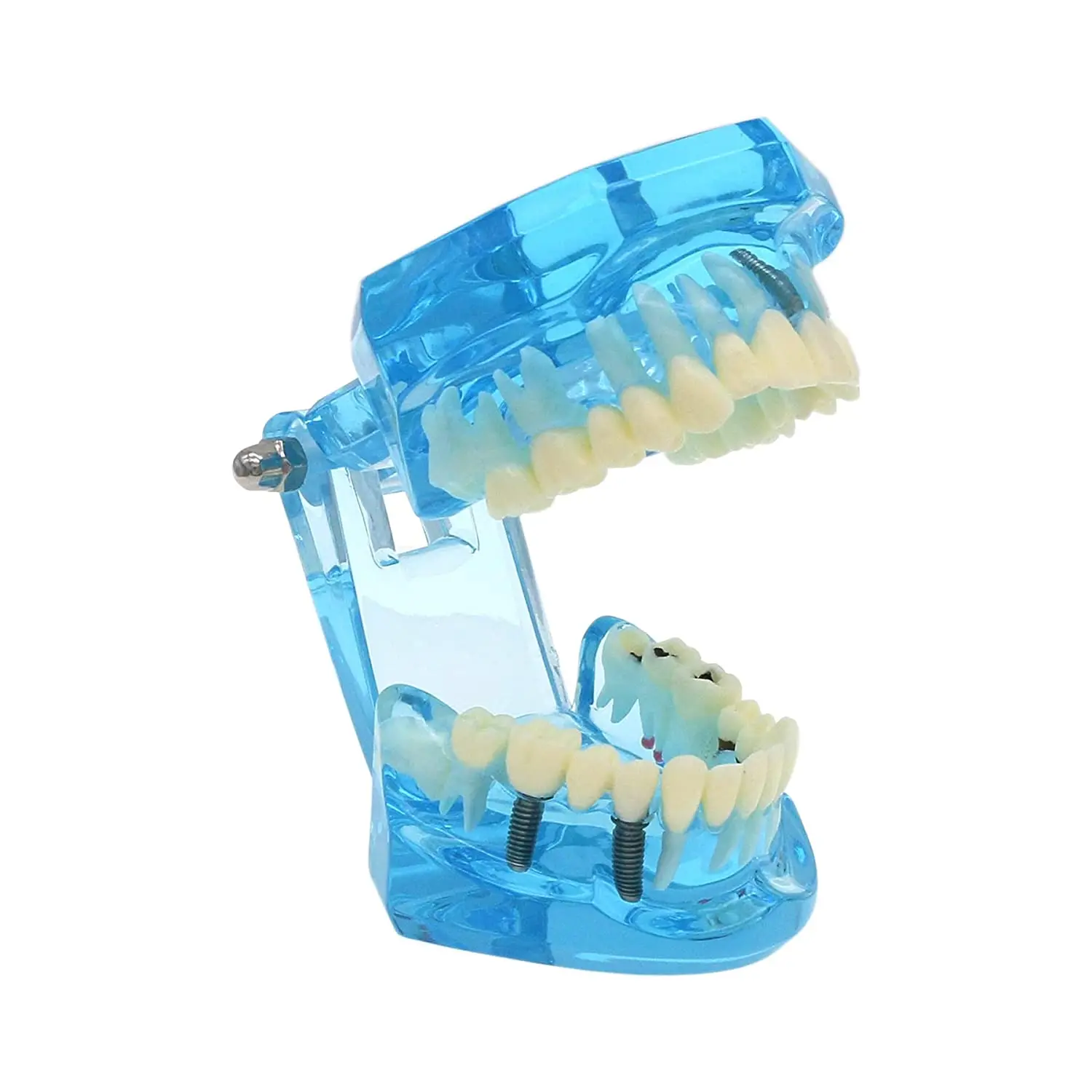 Transparent Typodont Adult Teeth Model Dental Implant Restoration Disease Pathology With Removable Teeth For Teaching Study