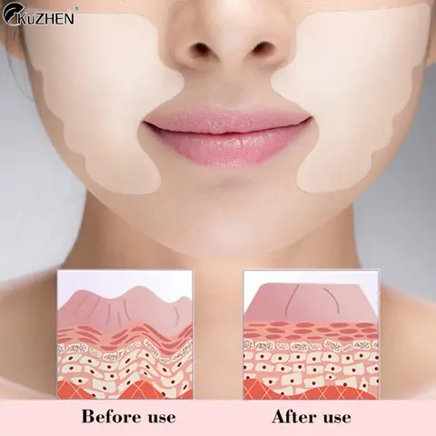 얼굴 주름 제거 패드, 재사용 가능 의료 등급 실리콘 팔자 주름, 안티 에이징 마스크, 주름 방지 피부 리프팅 패치