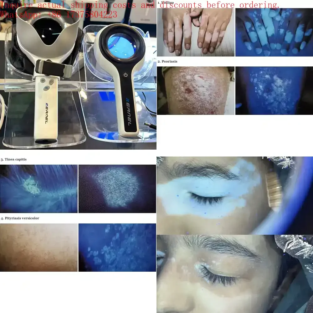 The Ultimate Analysis Tool: Multi-Purpose Woods Lamp for Pigmentation, Infection and Metabolic Disorder Screening