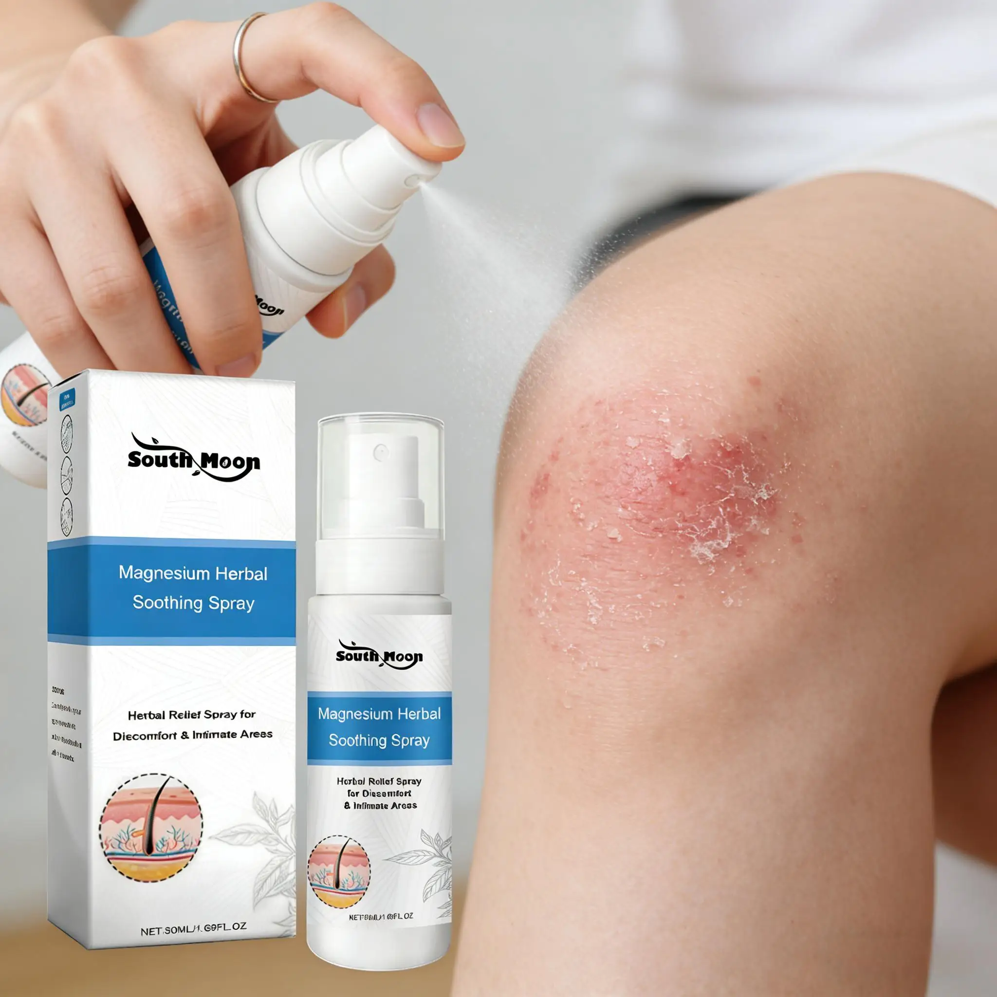 Spray Herbal para Aliviar la Psoriasis, Reduce la Picazón y la Sensación de Ardor, Reconstruye la Barrera Cutánea, Suprime las Lesiones, Bruma Hidratante Relajante