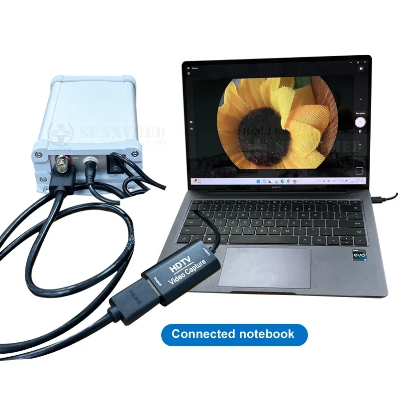 SY-P031HD5 Full HD Medical Endoscope Camera Portable 1080P Endoscope HD USB Camera with led Light source