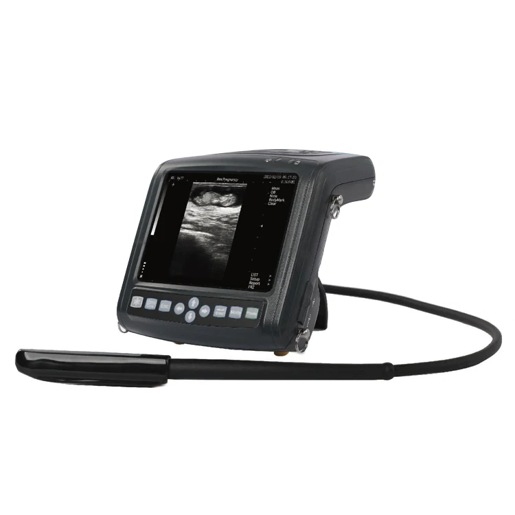 Portable Ultrasound…