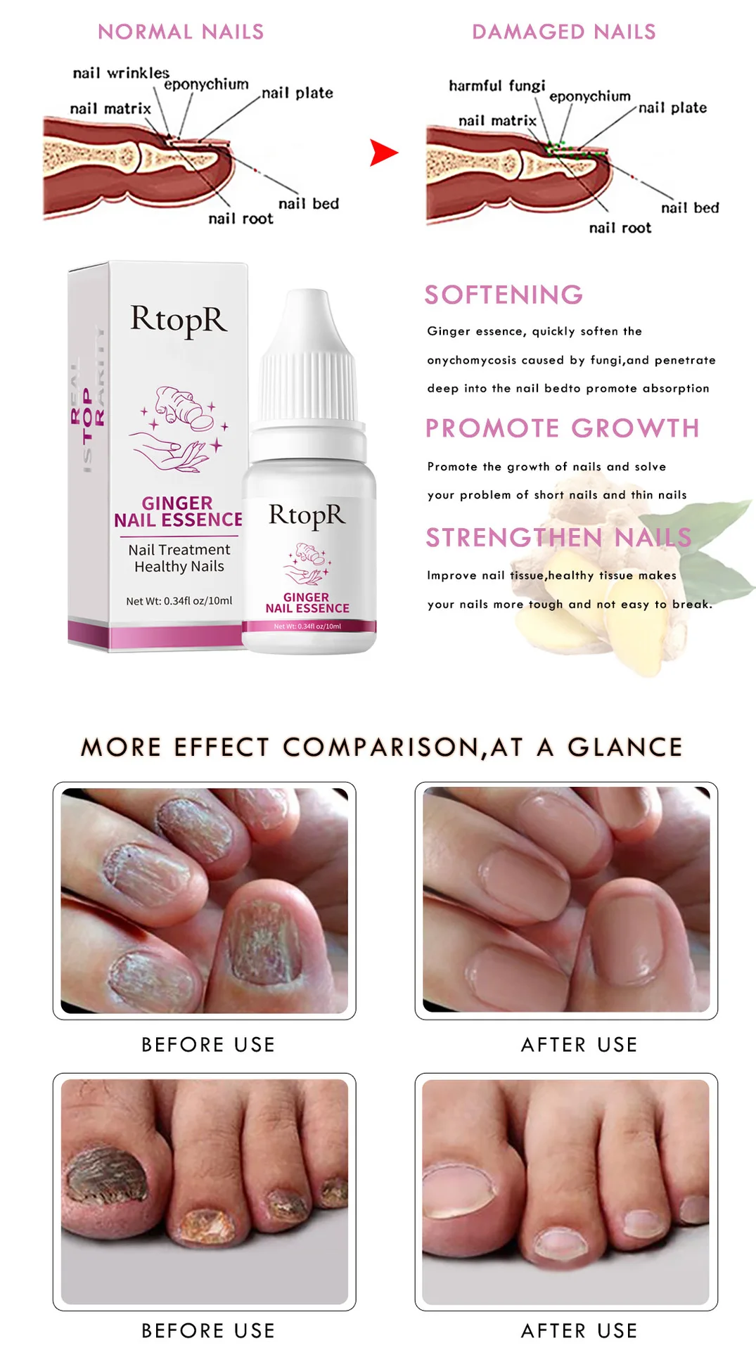 10ml Ginger Nail Essence nutriente unghie ruvide Anti Paronychia addensare Crack Nail Repair siero per il trattamento delle infezioni dell'unghia del piede