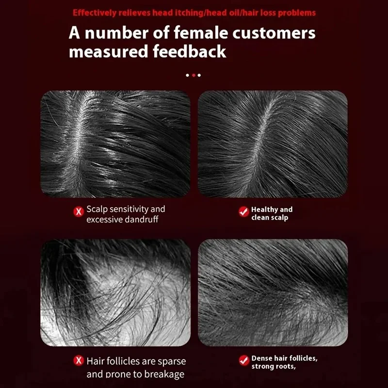 Electric Vibration Massage Comb Hair Care Brush Scalp Oil Applicator Red Light Therapy Hair Follicle Growth Comb Anti Loss view 3
