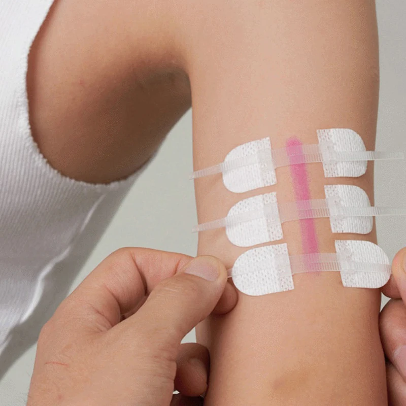 3 buah/set ikat ritsleting penutup luka Patch hemostatik Patch luka cepat menjahit ritsleting Band-Aid luar ruangan portabel