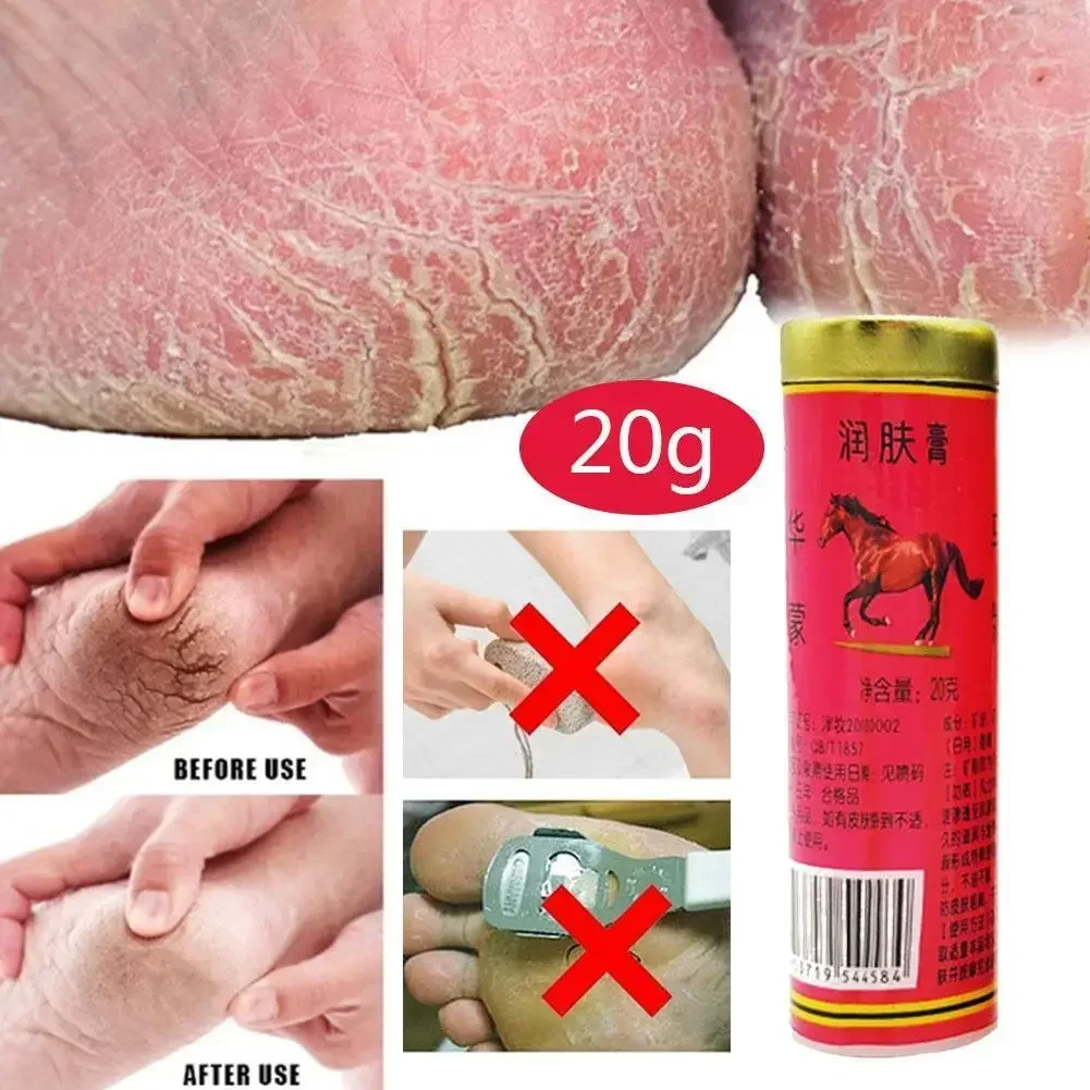 1Pcs 20g Horse Oil Skin Cream Anti-cracking Ointment Prevents Dry Skin Moisturizes Protects Fingers Feet And Skin Care Products