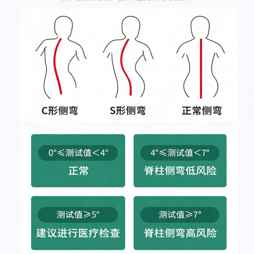 Spine Curvature Measurement Gauge Scoliosis Detecting Ruler Back Posture Assessment Tool Professional Health Monitor