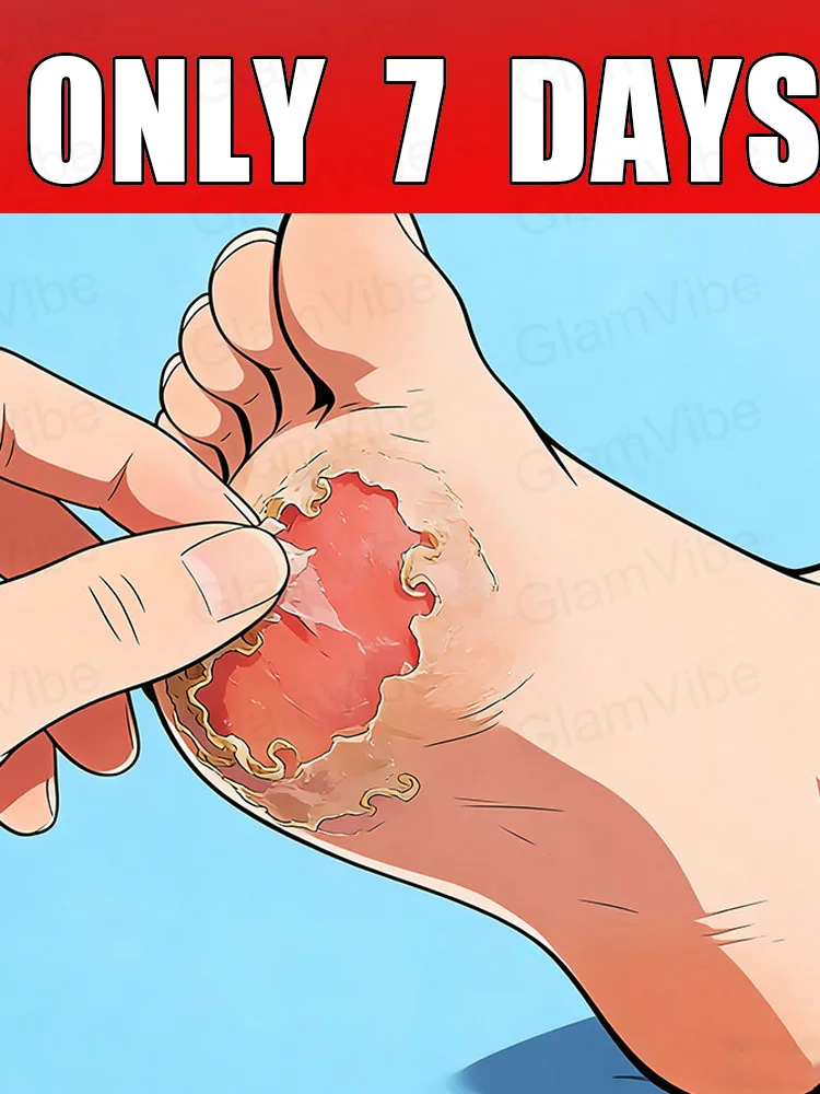 

This product is suitable for most people and can help those with peeling feet solve this problem, allowing them to enjoy a happy