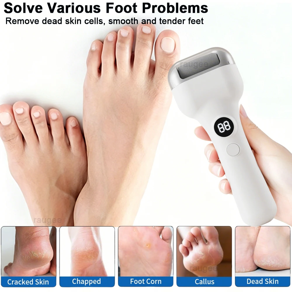 Electric Foot Grinder Rechargeable USB Callus Remover for Feet Professional Foot Care Heel Dead Skin Roller Pedicure Remover Kit - view 2