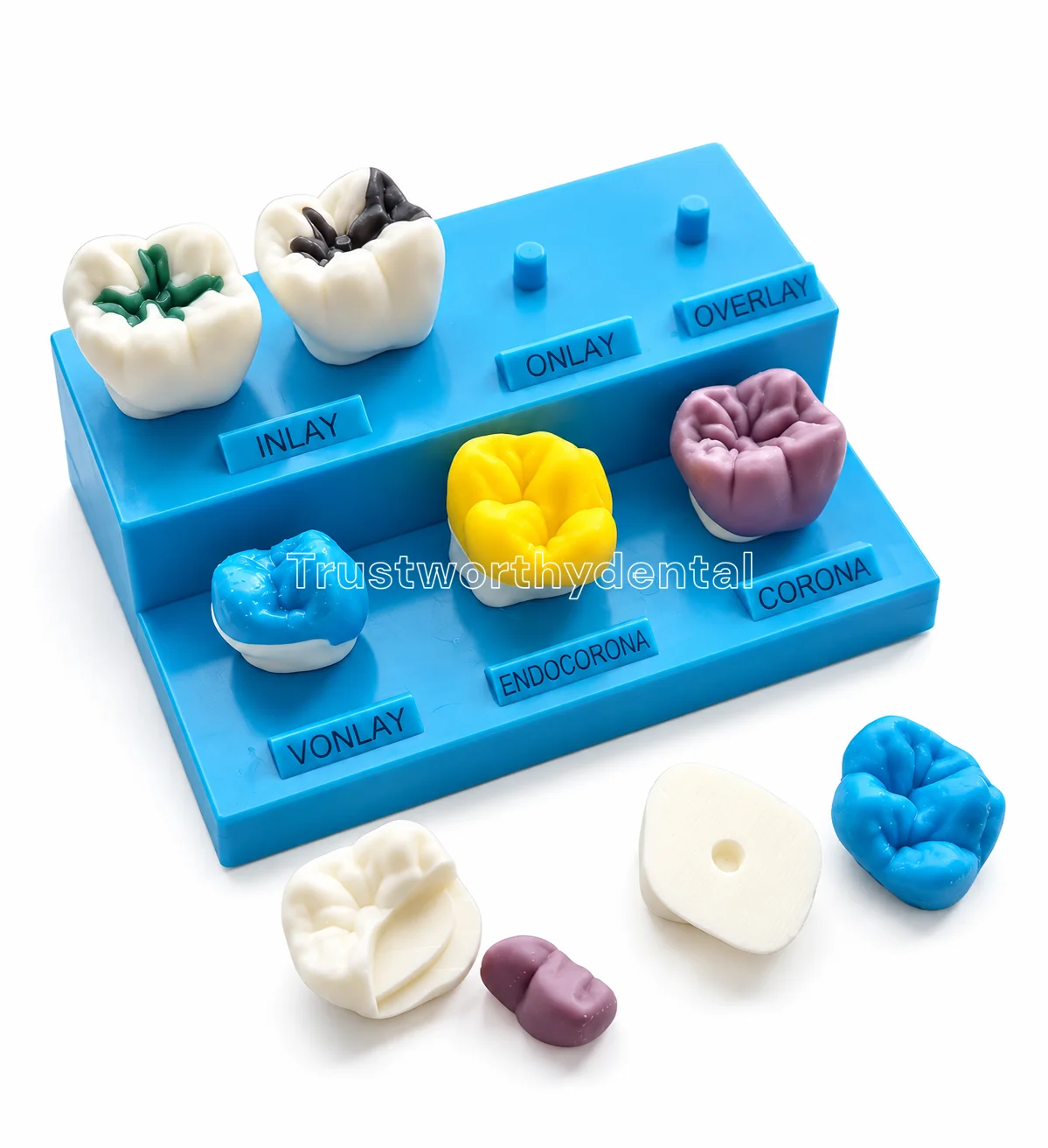 Dental Teaching Tooth Model Removable Inlay Crown Display Model High Onlay Restoration Demo Teeth Model Patient Communication