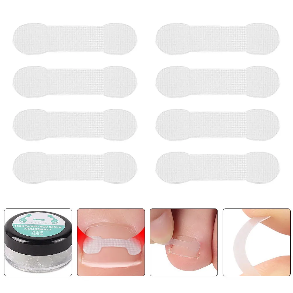 

30Pcs Ingrown Toenail Corrector Stickers Orthopedic Strip for Toenail Pain Relief Bunion Support Flexible Adhesive-Free Patch
