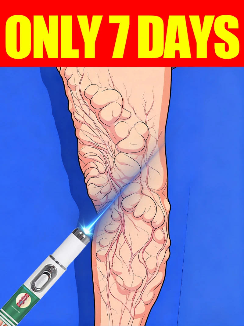 قلم الضوء الأزرق يوفر الدوالي والساقين العنكبوتية خلال 7 أيام