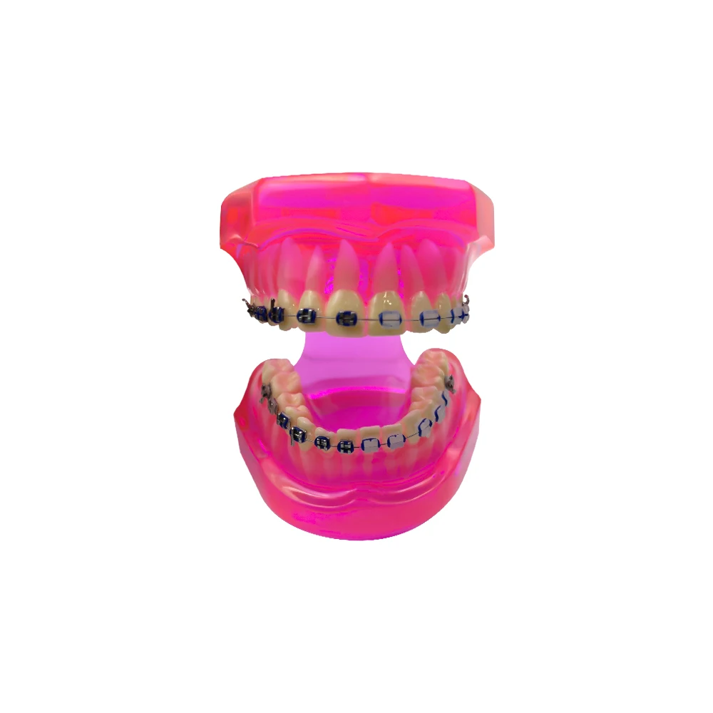 Dentistry Orthodontic Model Typodont Half Metal Half Ceramic Ortho Dental Teeth Model For Studying Teaching Patient Education