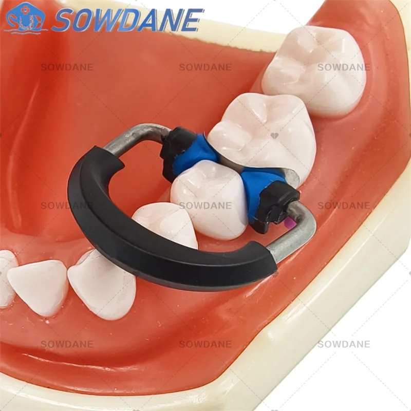 Dental NITI Clamping Ring Fit Palodent V3 System Nickel Titanium Sectional Matrice Band NITI PEEK Flexible Dentistry Tool