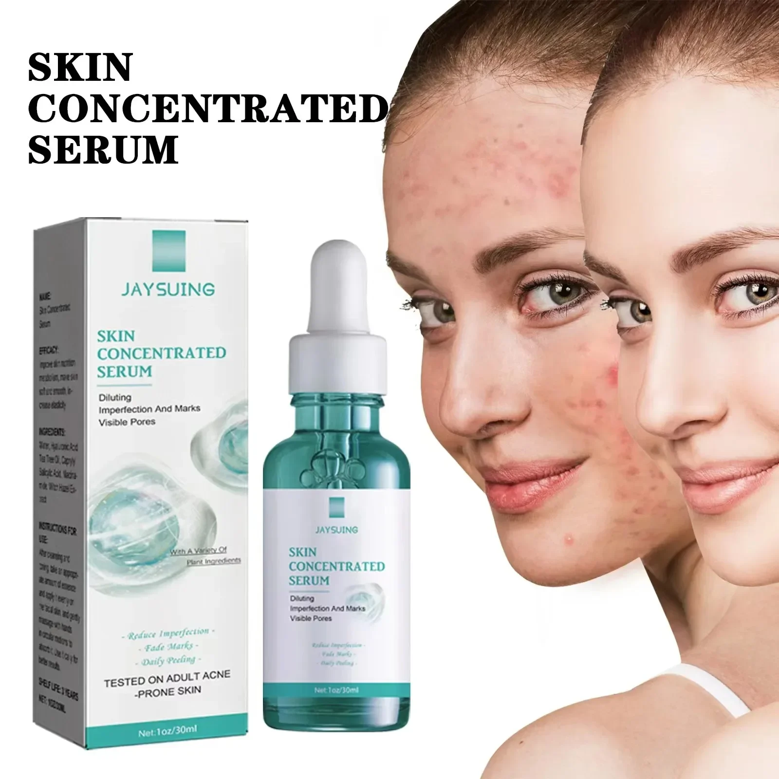 

30ml Skin Concentrated Face Serum Oil Control Remove Marks Shrink Pores Moisturizing Hydrating Facia Repair Serum Skin Care
