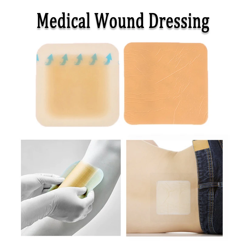 Alginate Wound Hydrocolloid Dressing Polyurethane Foam Dressing Highly Absorbent Medical Sterile Wound Ulcer