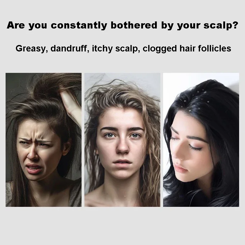 Useful Anti-Dandruff Massage Comb Anti-Static Anti Tangling Styling Tool Hair Brush Press Oil Massage Cleansing Comb Health Care