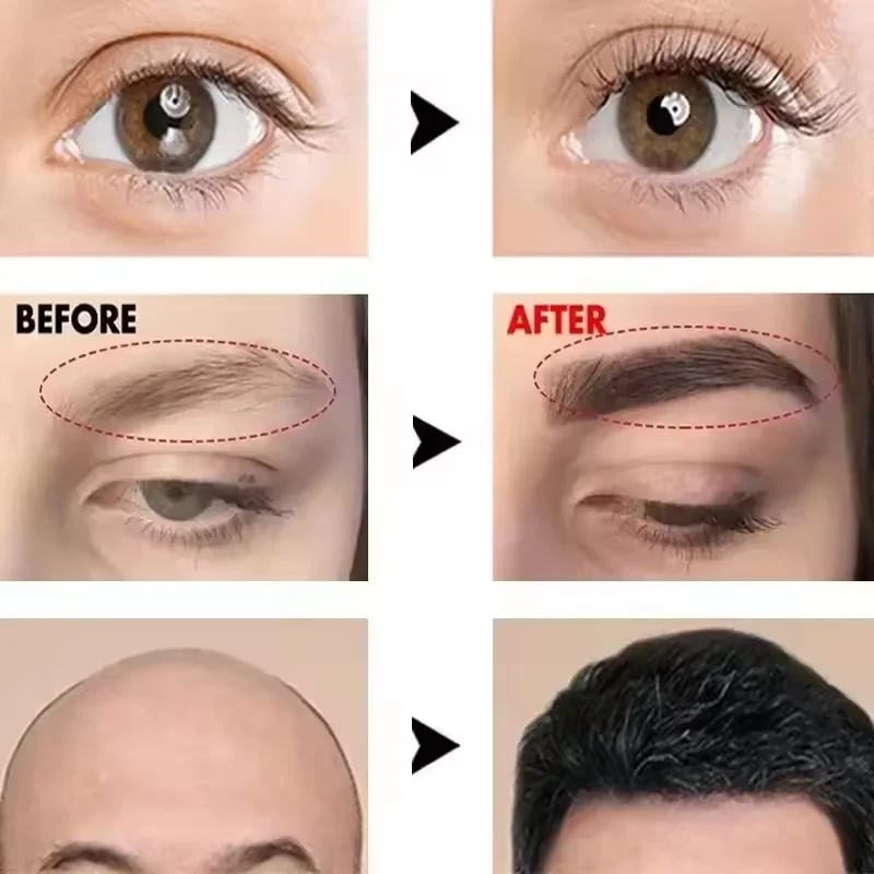 Soro de crescimento rápido de sobrancelha, crescimento de cílios, produto anti-perda de cabelo, prevenção de calvície, alongamento mais grosso, maquiagem de sobrancelha