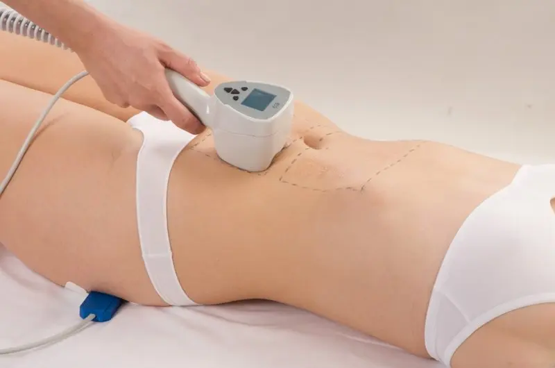 Ultra 360 Hautstraffung, Kollagenpistole, Cellulite-Reduktion, 2-in-1, unipolare Straffung der Haut, Körper, Abnehmen, Facelifting, Schönheitsmaschine – Detail 11