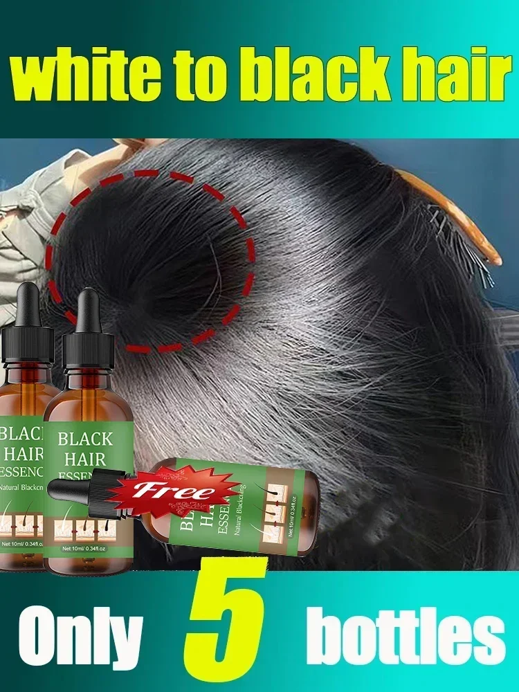 

Anti Gray Hair Serum Repair White & Darkening Natural White to black Hair Nourishing Hair Care Remedy