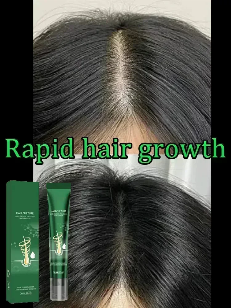 

Fast Effective Hair Growth Oil Ginger Anti-Loss Hair Regrowth Serum Prevent Baldness Scalp Treatments Alopecia Hair Health Care