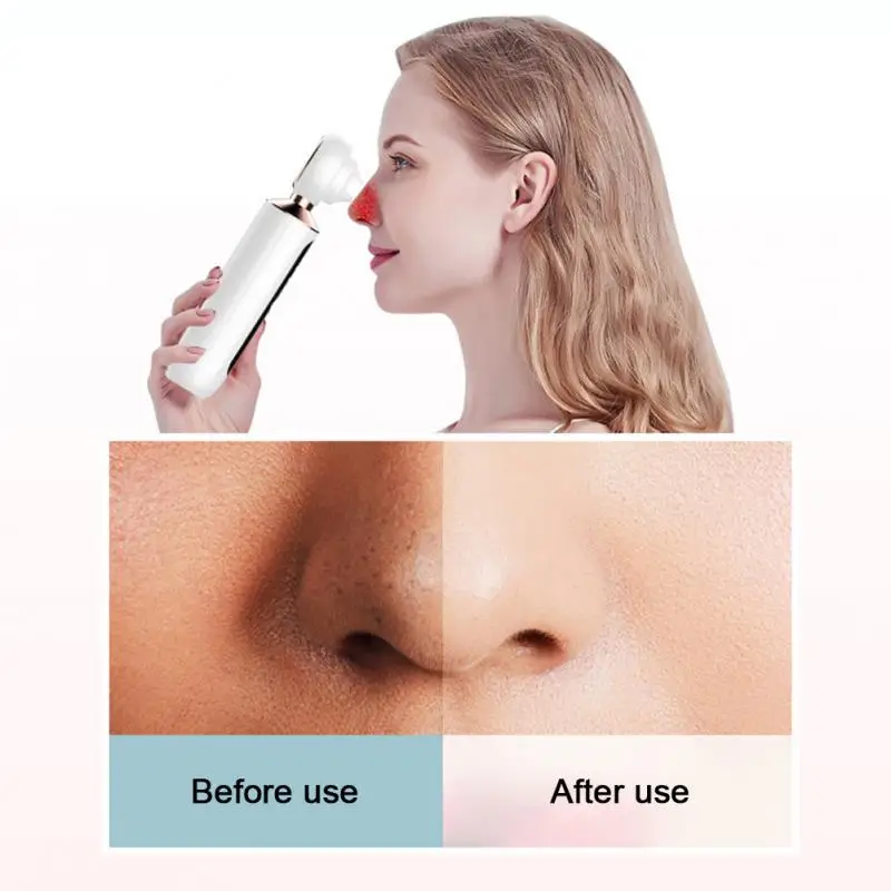 Electric Blackhead Remover Vacuum Cleaner Black Head Machine HD Camera Facial Pore Cleaser Microdermabrasion