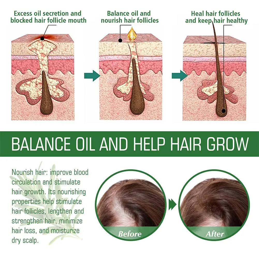 60 ミリリットルローズマリーヘアエッセンシャルオイル天然ローズマリー血清脱毛損傷した再成長修復縮れ頭皮薄毛髪 A M5R3