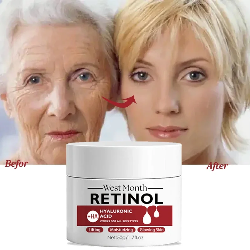 Retinol Rimpel Verwijderaar Gezichtscrème Verstevigende Lifting Anti Veroudering Vervagen Fijne Lijntjes Hydraterende Whitening Huidverzorgingsproduct Cosmetisch