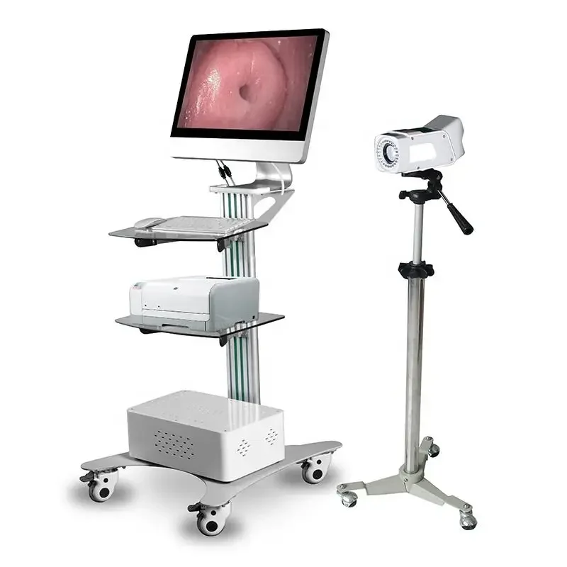 

YSSW3303A HD video colpos cope Optical colpos cope vagi nal came ra for Gynecology Vagina Examination digital video colpos cope