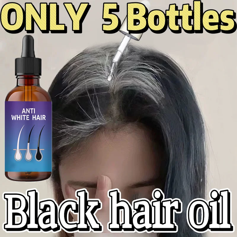 Gray White Hair Treatment Serum Liquid White To Black Natural Color Repair turns white into black, and prevents gray Men Women