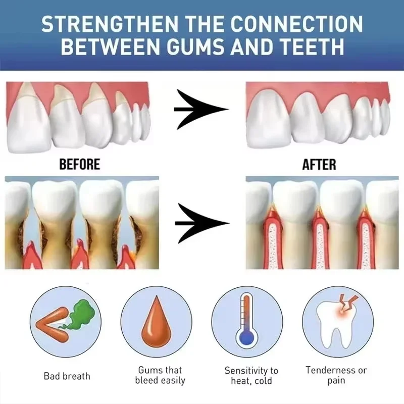 Rapid Repair Damaged Gums Gel Serum Relieve Sore Tooth Allergy Dental Caries Tooth Cleaning Toothpaste Deep Cleaning Teeth Stain