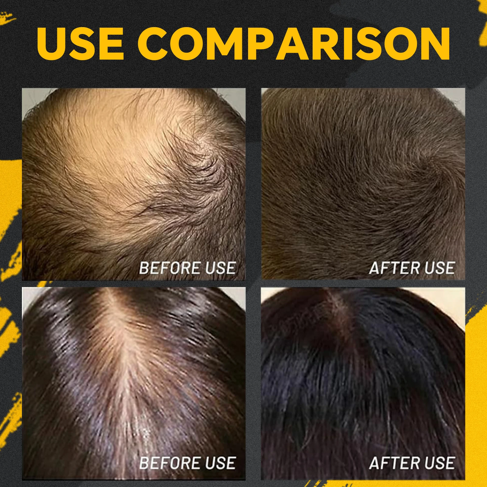 Hair Building Fiber Dense Hair Growth Natural Keratin Styling Powder Loss Bald Fibre Pack Building Hairline Optimizer